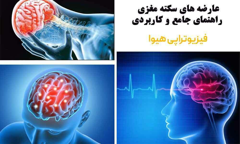 عارضه های سکته مغزی در قزوین