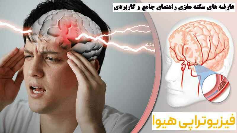 عارضه های سکته مغزی در قزوین