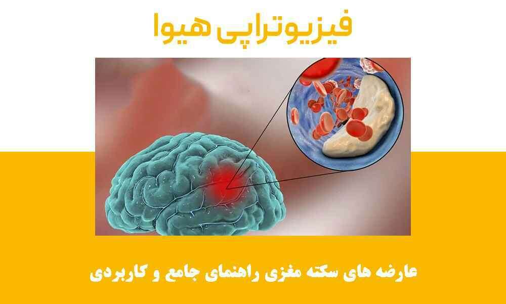 عارضه های سکته مغزی در قزوین