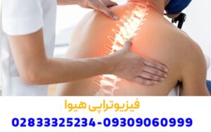 انواع فیزیوتراپی پس از سکته مغزی در قزوین