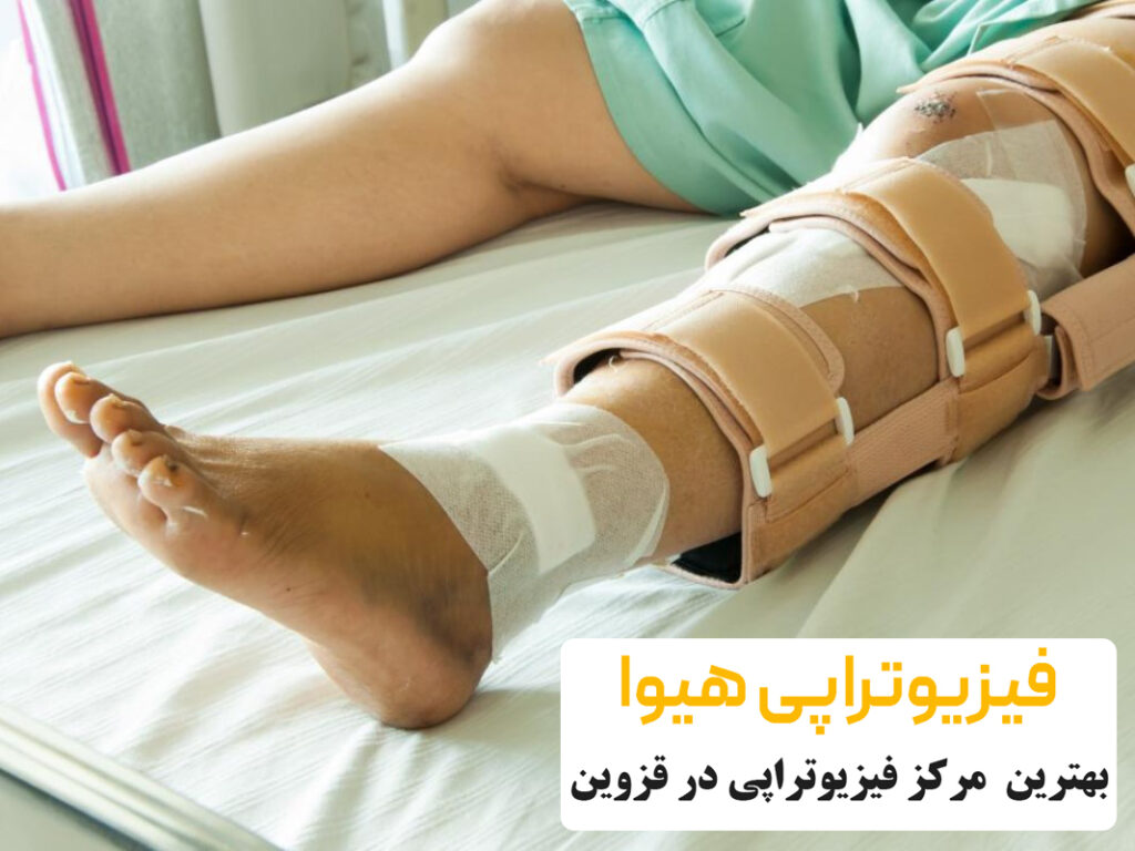 معرفی انواع شکستگی ساق پا و راه های درمان آن