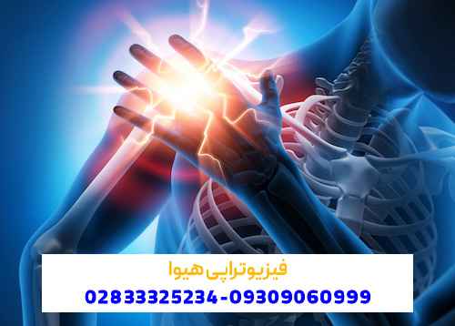 منظور از شانه یخ زده چیست و چه علائمی دارد