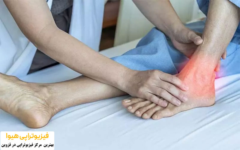 درمان نقرس و التهاب مفاصل با فیزیوتراپی