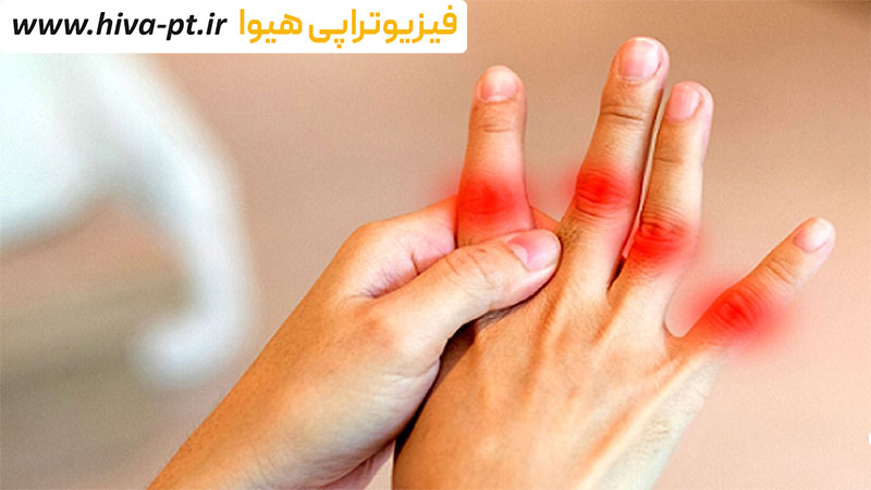 درمان نقرس و التهاب مفاصل با فیزیوتراپی