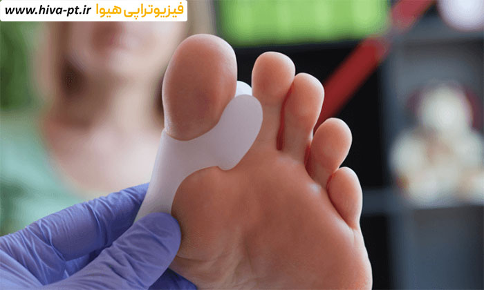 درمان هالوکس والگوس با فیزیوتراپی