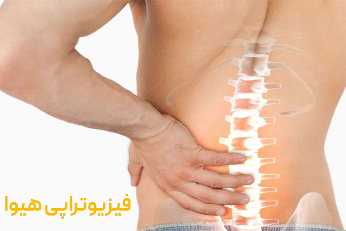 مراحل درمان دیسک کمر