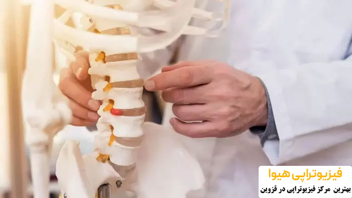 مراحل درمان دیسک کمر