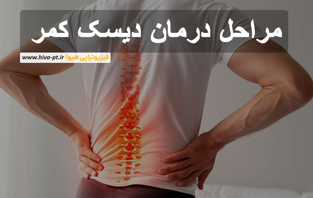مراحل درمان دیسک کمر