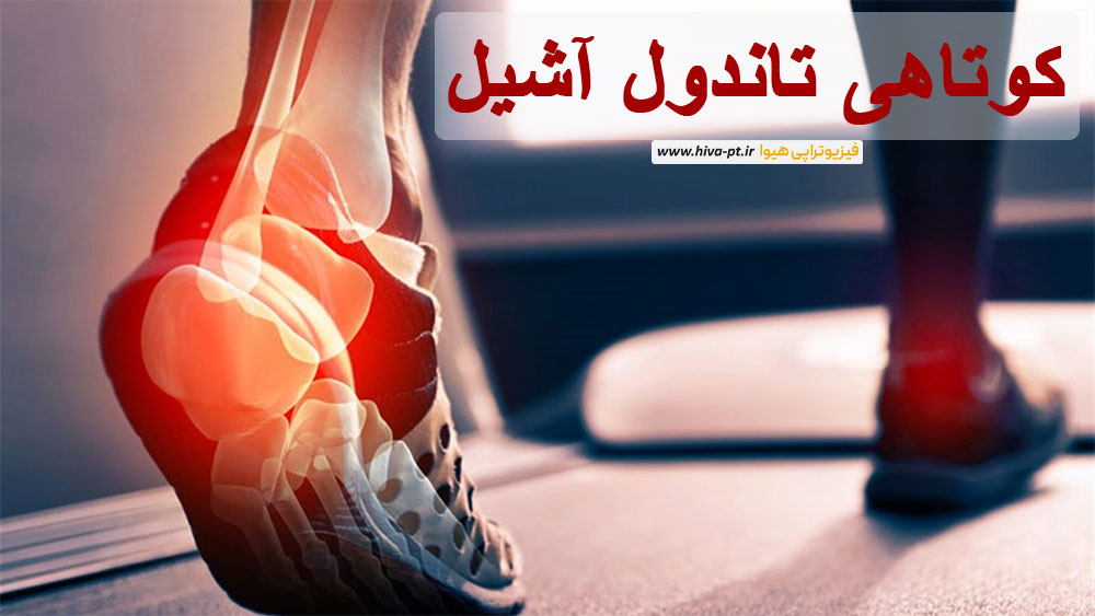 همه چیز درباره کوتاهی تاندول آشیل
