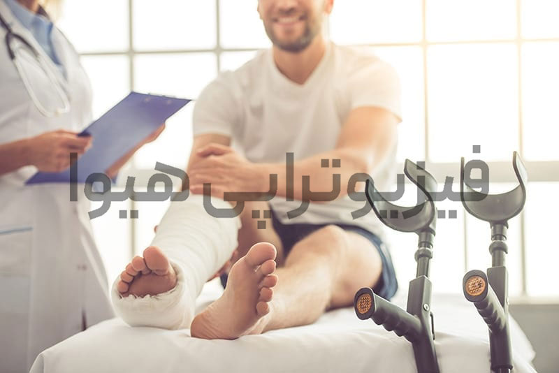 فیزیوتراپی بعد از باز کردن گچ پا