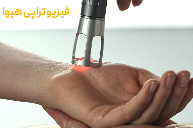 فیزیوتراپی بعد از عمل CTS