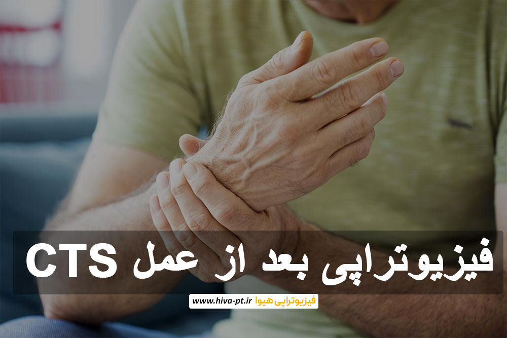 فیزیوتراپی بعد از عمل CTS