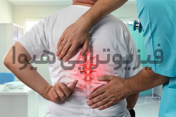 فیزیوتراپی بعد از عمل فیوژن کمر