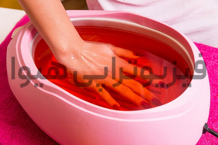 پارافین درمانی یا حمام پارافین