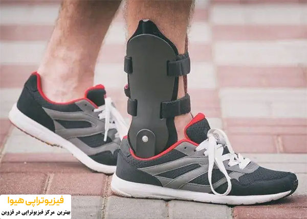 دراپ فوت (drop foot) چیست؟