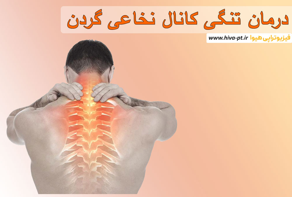 درمان تنگی کانال نخاعی گردن با فیزیوتراپی