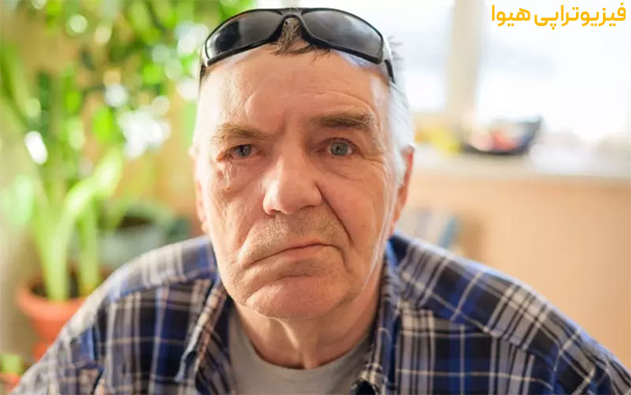 بررسی عوارض مهم فلج بلز