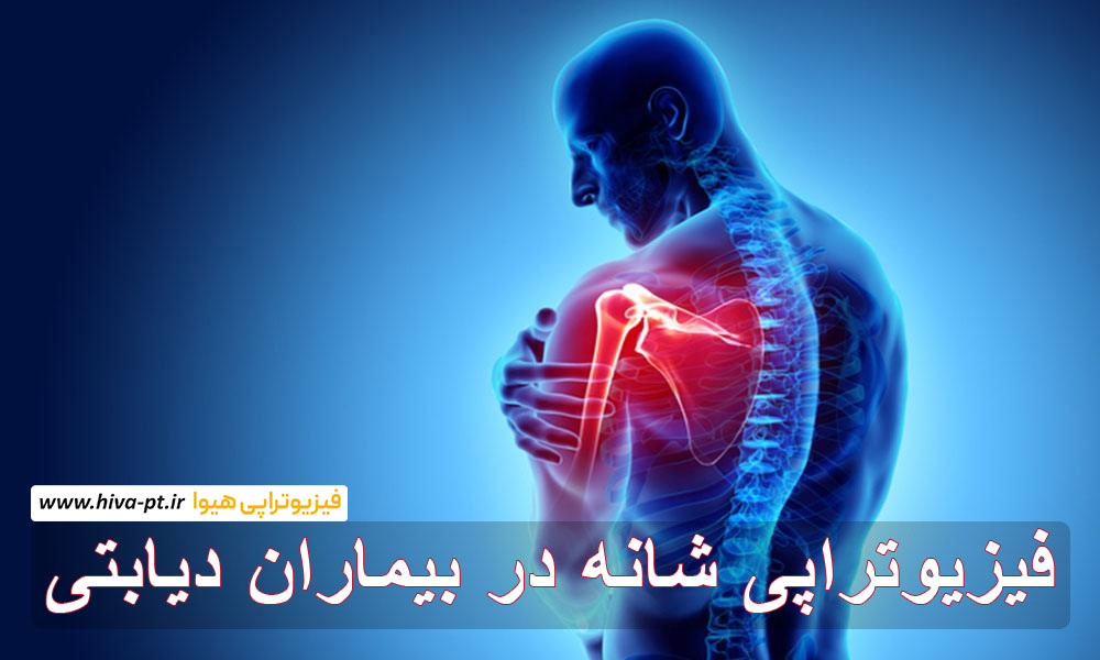 فیزیوتراپی شانه در بیماران دیابتی