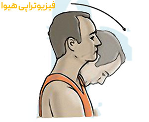 معرفی 8 ورزش برای درمان دیسک گردن