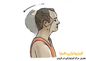 معرفی 8 ورزش برای درمان دیسک گردن
