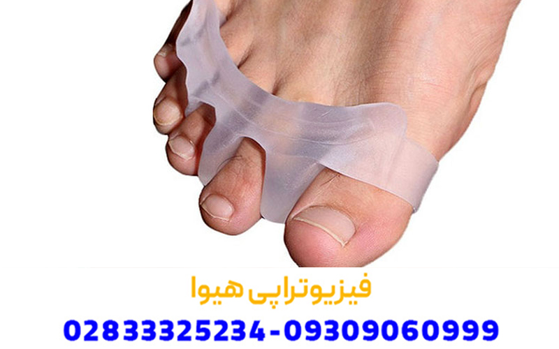 درمان خانگی انگشت چکشی