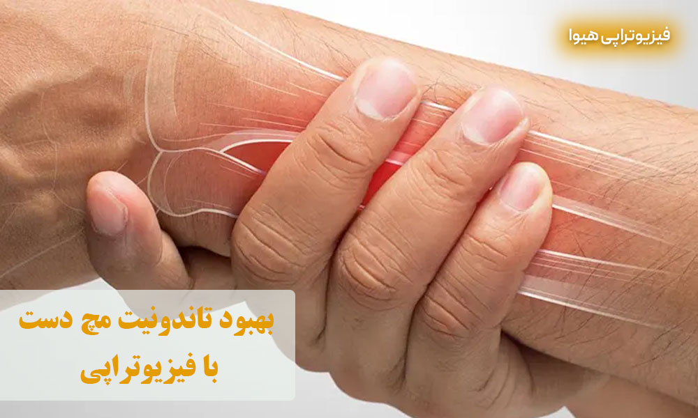 بهبود تاندونیت مچ دست با فیزیوتراپی 