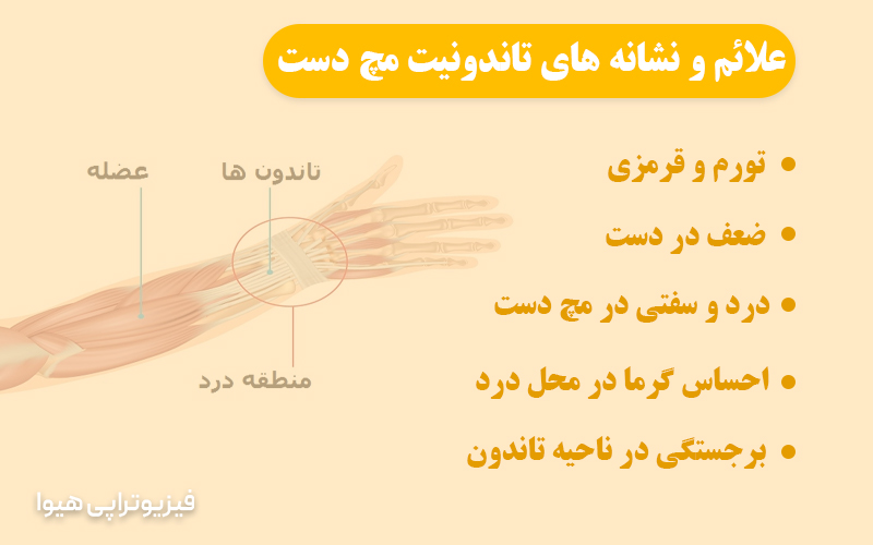 علائم و نشانه ‌های تاندونیت مچ دست