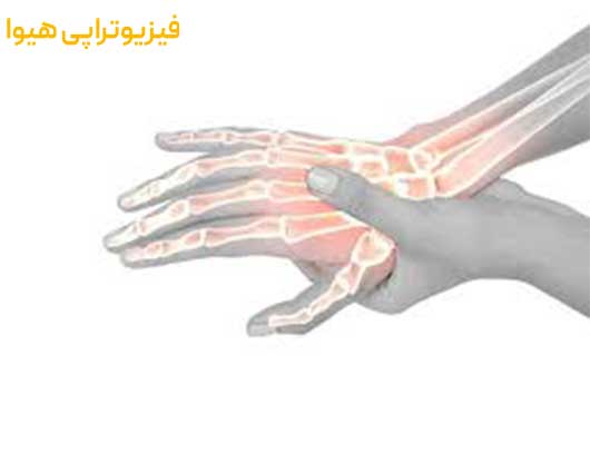 درمان روماتیسم مفصلی