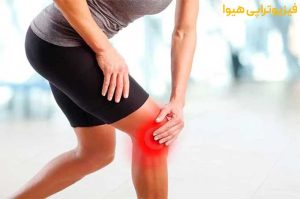 درمان سندرم پلیکا با فیزیوتراپی
