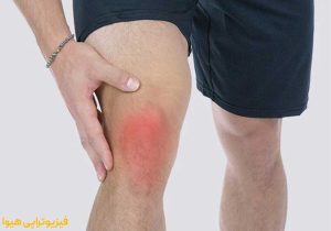 بورسیت زانو چیست؟
