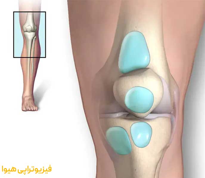 علائم بورسیت زانو
