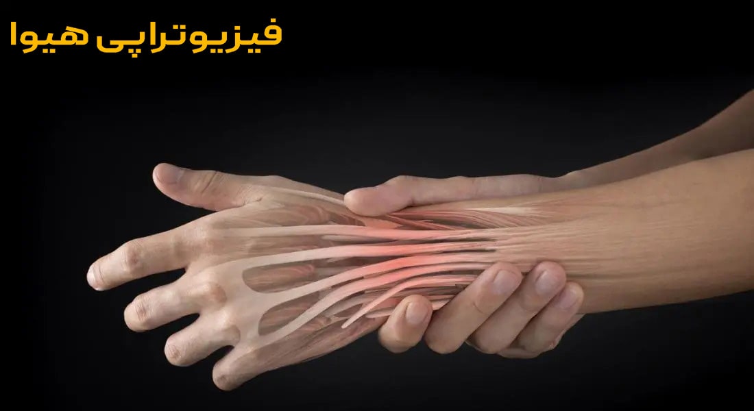 تاندون دست چیست؟ علائم پارگی تاندون دست