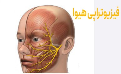 مدت زمان و مراحل بهبود فلج عصب صورت