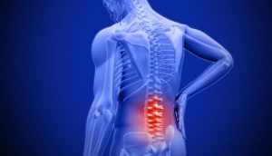 علت و علائم همانژیوم کمر چیست؟