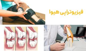 پارگی رباط زانو