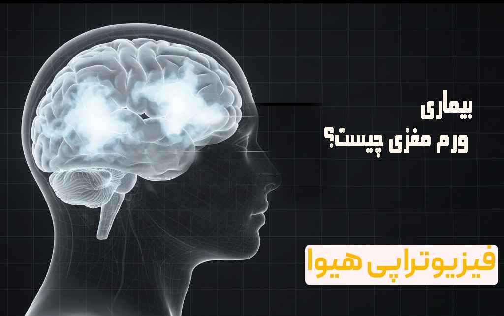 بیماری ورم مغزی