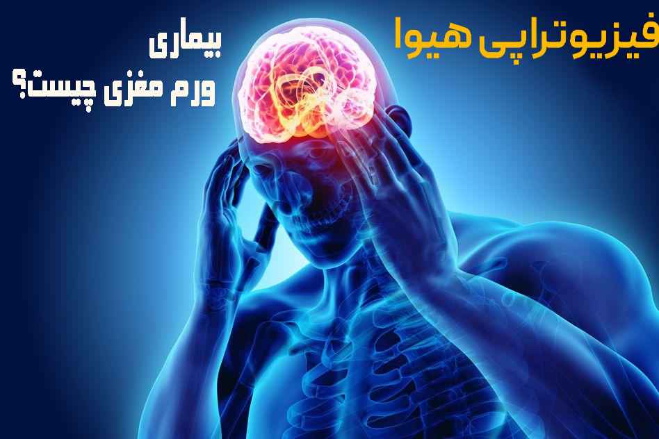 بیماری ورم مغزی