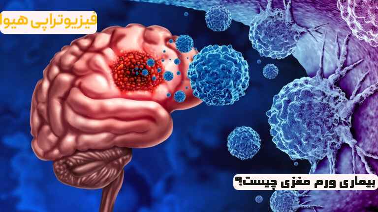 بیماری ورم مغزی
