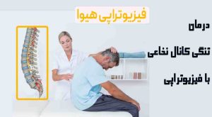 درمان تنگی کانال نخاعی با فیزیوتراپی