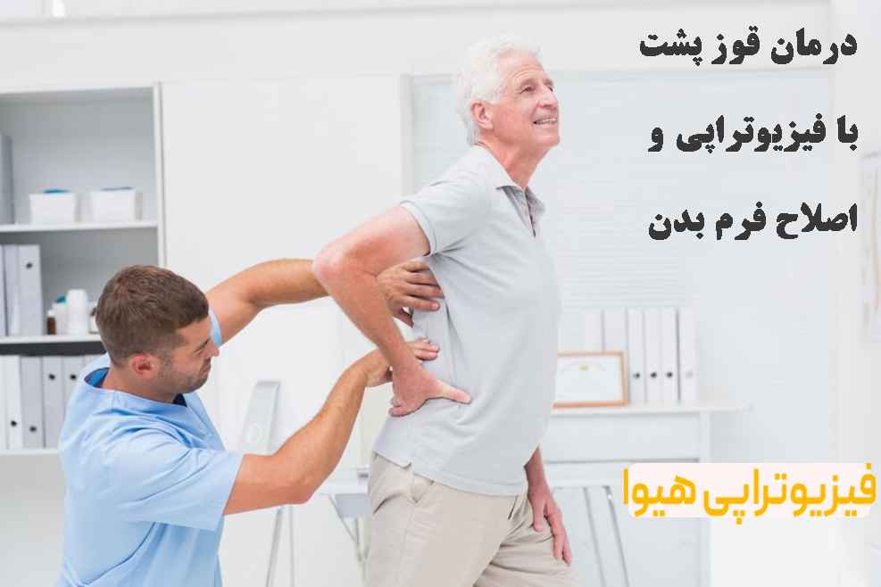درمان قوز پشت با فیزیوتراپی