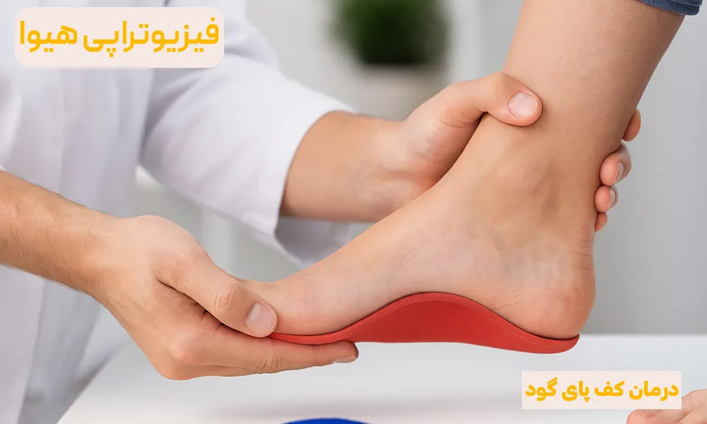 درمان کف پای گود