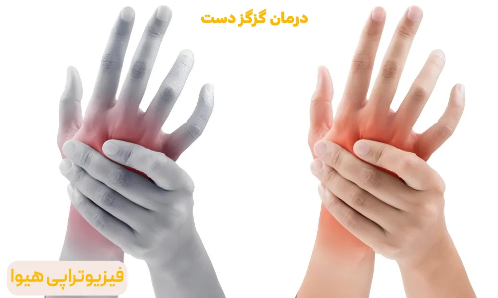 درمان گزگز دست