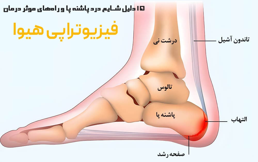 15 دلیل شایع درد پاشنه پا و راه‌های موثر درمان
