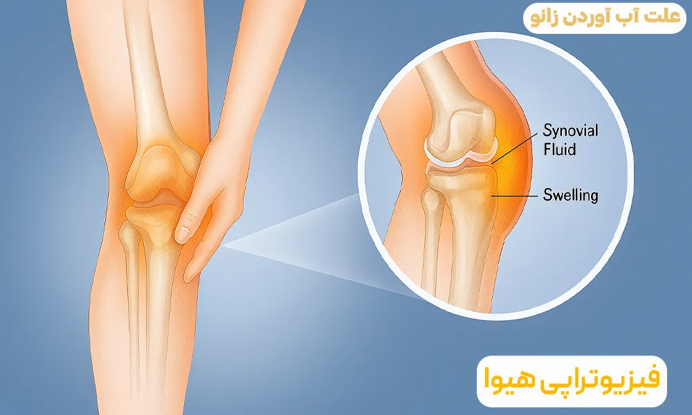 علت آب آوردن زانو