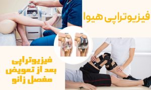 فیزیوتراپی بعد از تعویض مفصل زانو