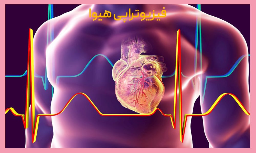 فیزیوتراپی بعد از عمل قلب باز