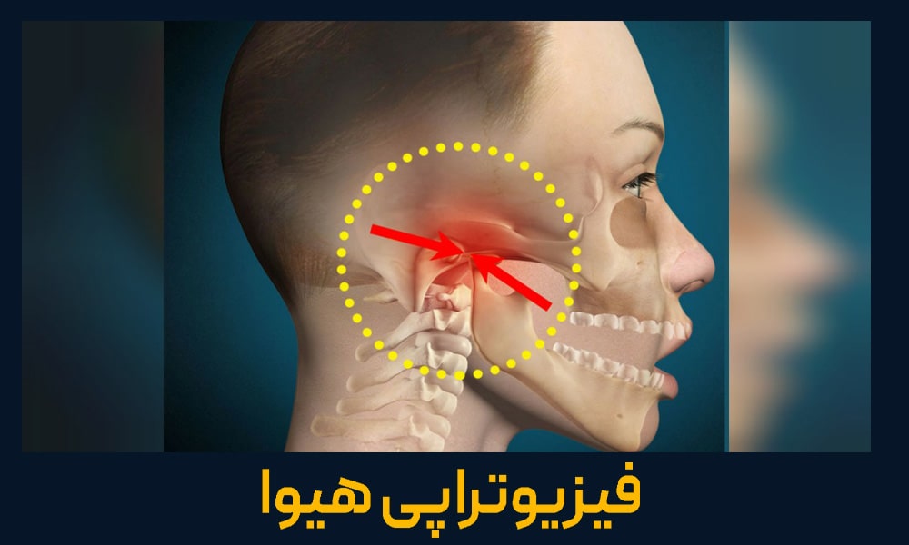 قفل شدن فک یا تریسموس چیست؟