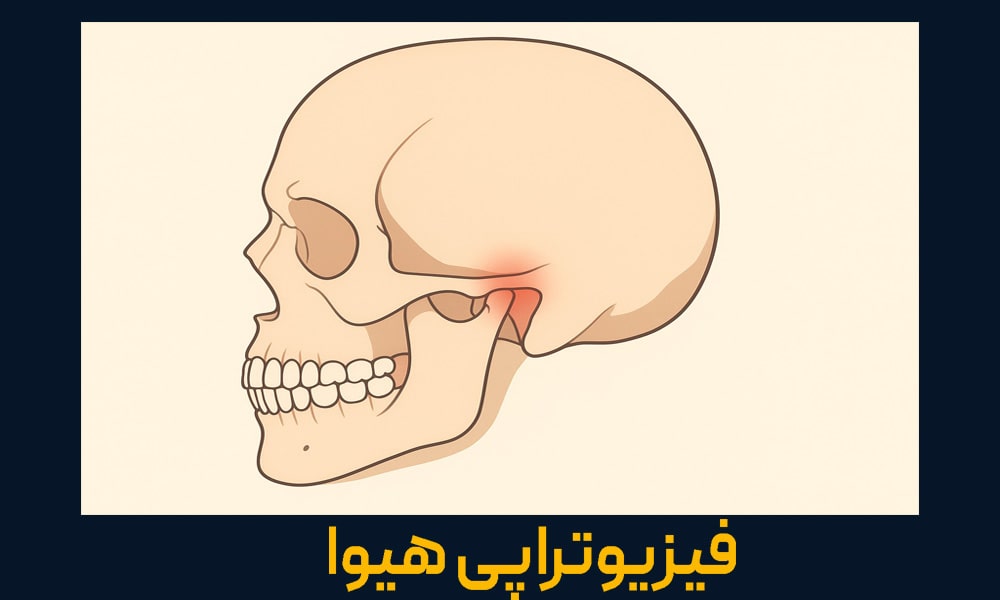 قفل شدن فک یا تریسموس چیست؟