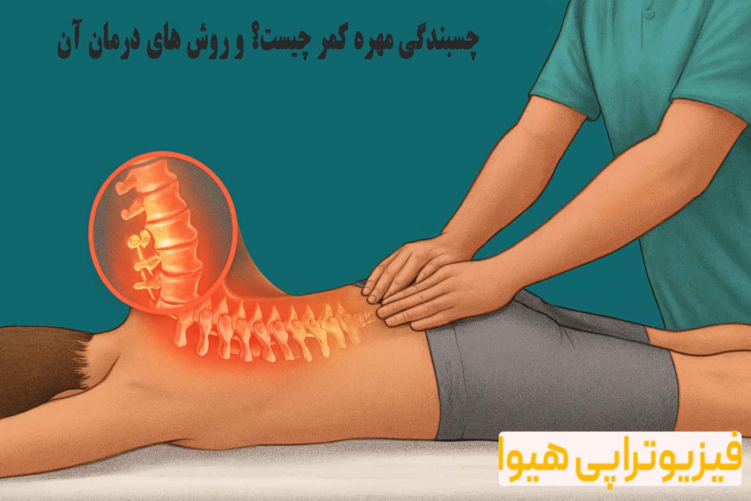 چسبندگی مهره کمر