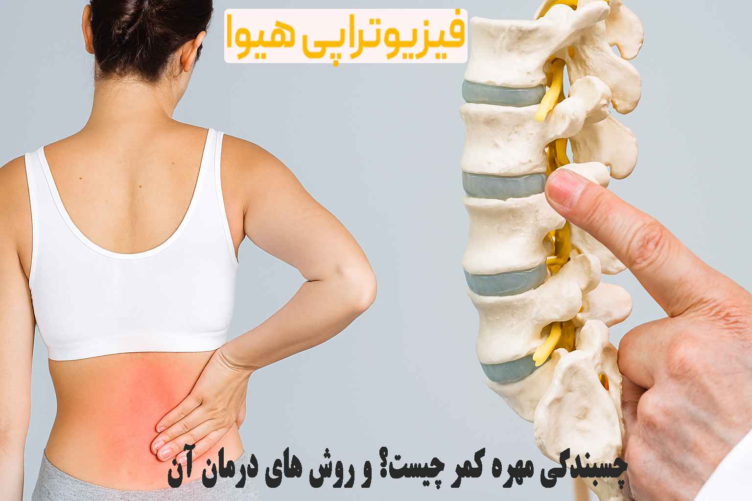 چسبندگی مهره کمر